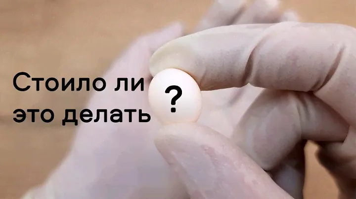 Сложный выбор. Маленькая жизнь в наших руках.